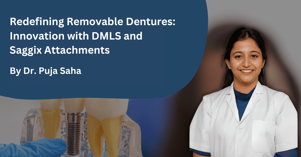 Redefining Removable Dentures: Innovation with DMLS and Saggix Attachments